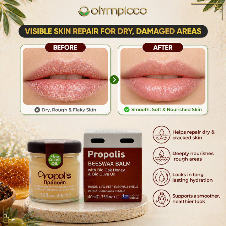 Melira Propolis Beeswax Balm with Organic Oak Honey & Olive Oil | Dermatologically Tested | Natural Repair for Dry & Sensitive Skin | Made in Greece - OLYMPICCO.COM